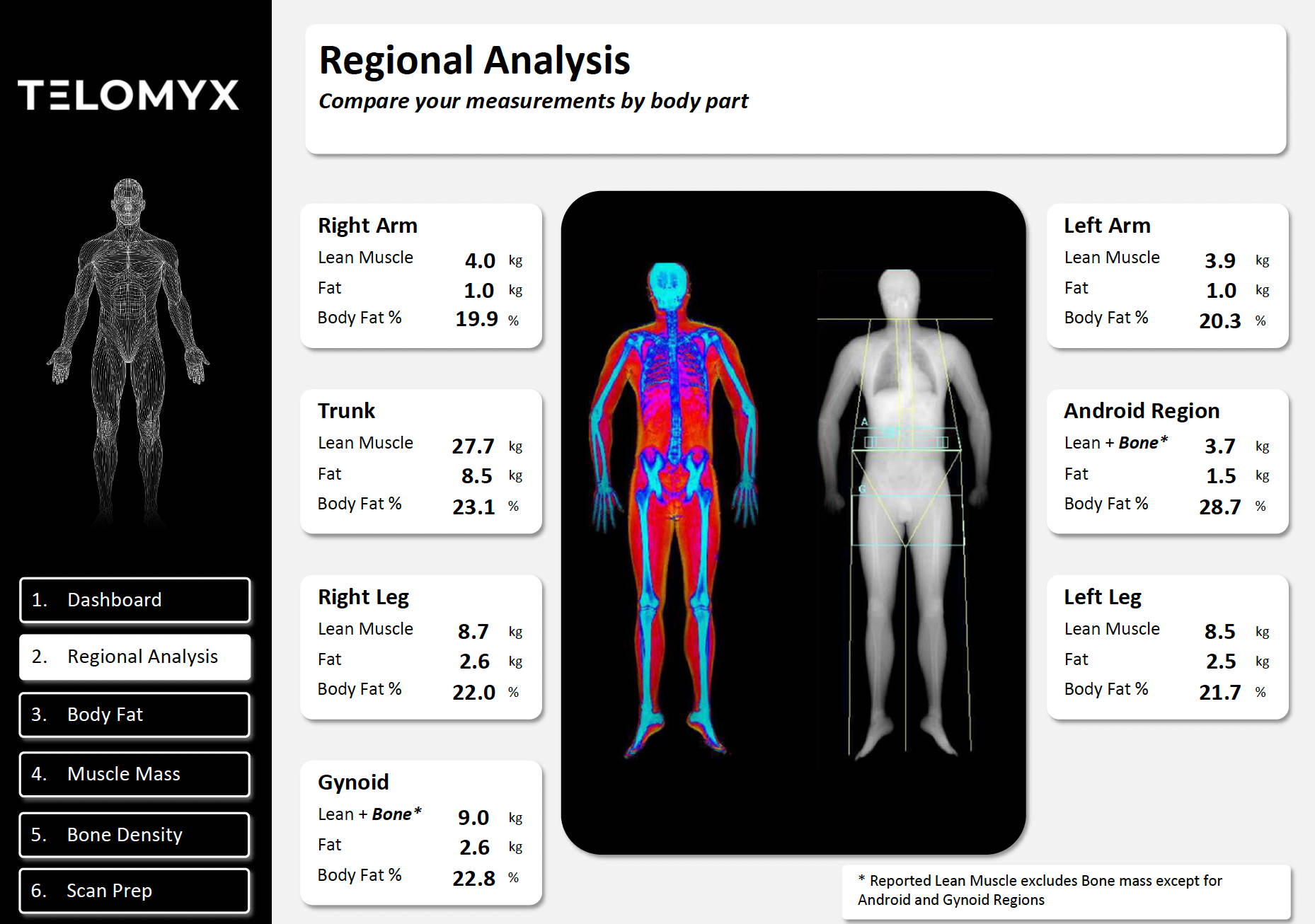 The regional analysis section of the Telomyx DEXA report