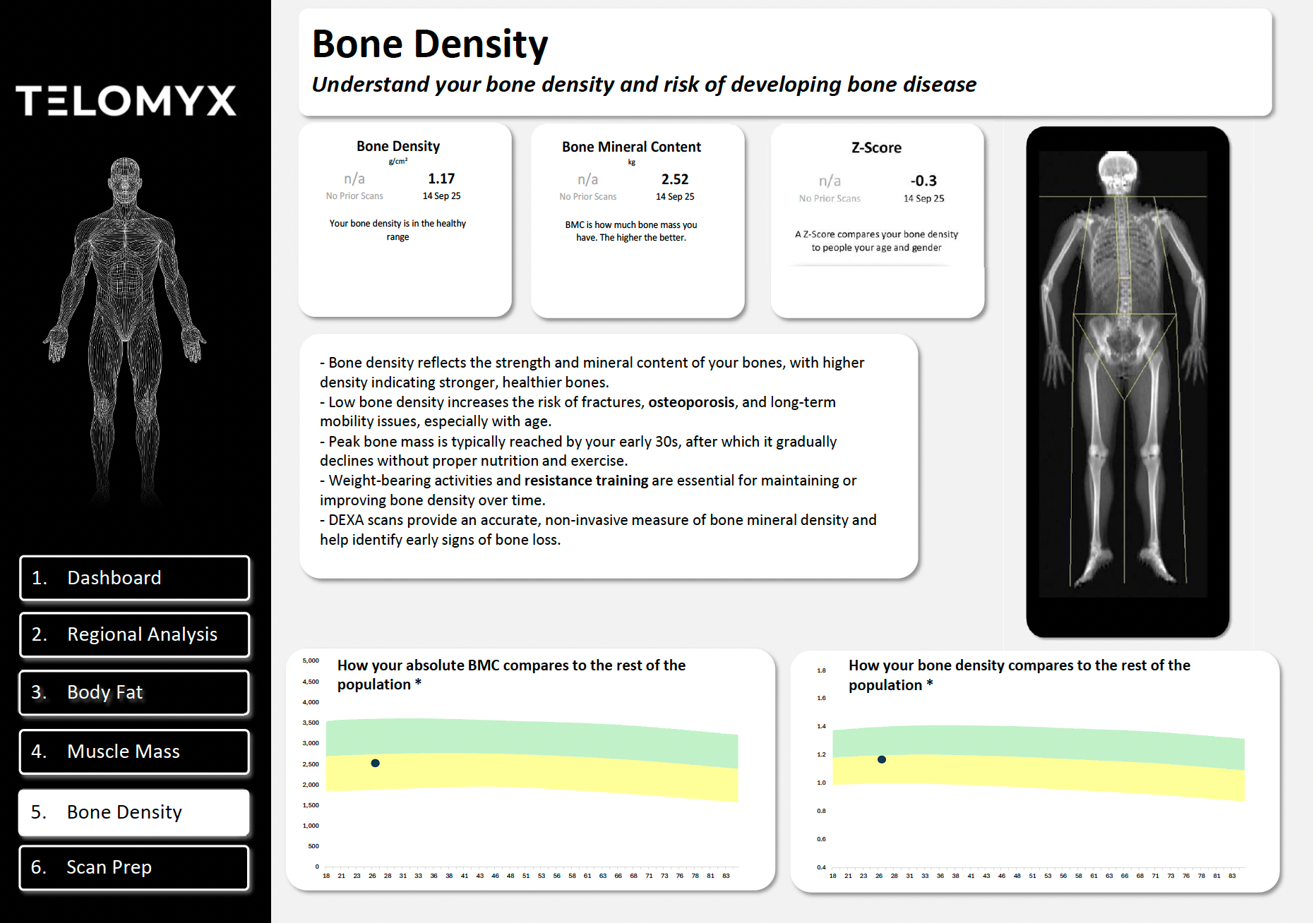 The bone density section of the Telomyx DEXA report